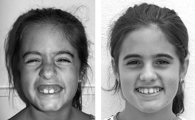 Иллюстрация к книге — Укус эволюции. Откуда у современного человека неправильный прикус, кривые зубы и другие деформации челюсти [i_058.jpg]