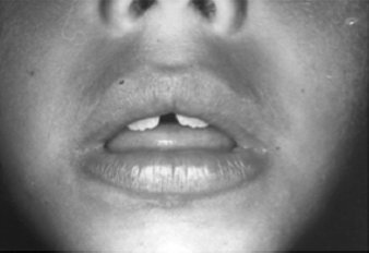 Иллюстрация к книге — Укус эволюции. Откуда у современного человека неправильный прикус, кривые зубы и другие деформации челюсти [i_061.jpg]