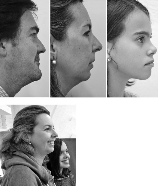 Иллюстрация к книге — Укус эволюции. Откуда у современного человека неправильный прикус, кривые зубы и другие деформации челюсти [i_062.jpg]