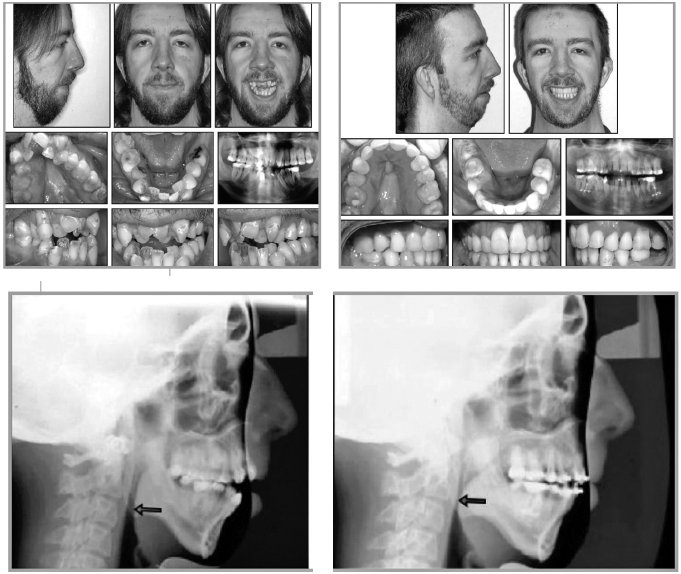 Иллюстрация к книге — Укус эволюции. Откуда у современного человека неправильный прикус, кривые зубы и другие деформации челюсти [i_063.jpg]