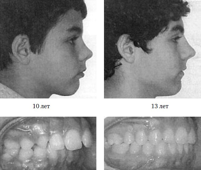 Иллюстрация к книге — Укус эволюции. Откуда у современного человека неправильный прикус, кривые зубы и другие деформации челюсти [i_064.jpg]