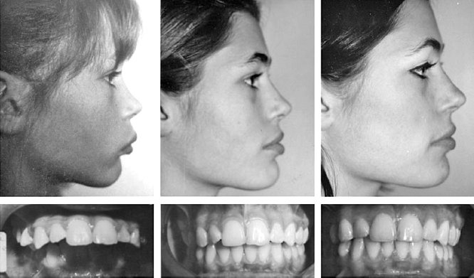 Иллюстрация к книге — Укус эволюции. Откуда у современного человека неправильный прикус, кривые зубы и другие деформации челюсти [i_067.jpg]