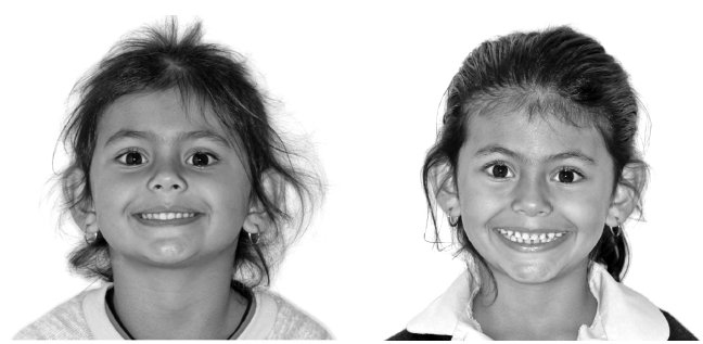 Иллюстрация к книге — Укус эволюции. Откуда у современного человека неправильный прикус, кривые зубы и другие деформации челюсти [i_071.jpg]