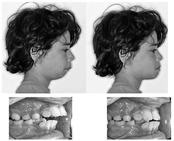 Иллюстрация к книге — Укус эволюции. Откуда у современного человека неправильный прикус, кривые зубы и другие деформации челюсти [i_073.jpg]