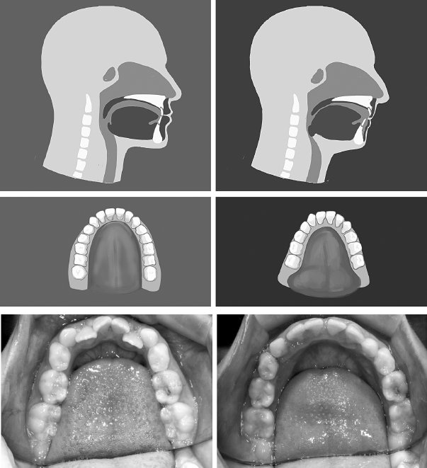 Иллюстрация к книге — Укус эволюции. Откуда у современного человека неправильный прикус, кривые зубы и другие деформации челюсти [i_074.jpg]