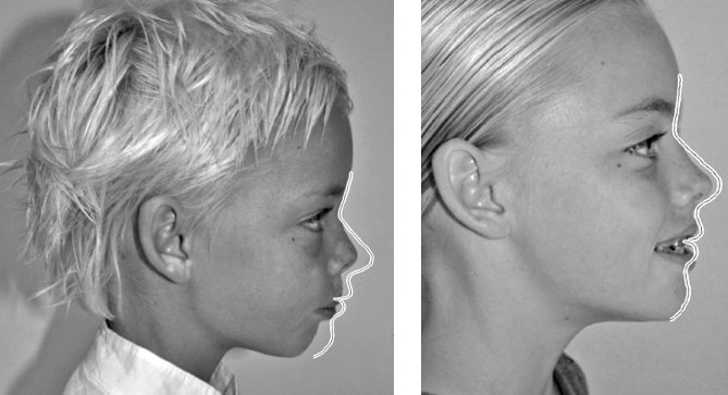 Иллюстрация к книге — Укус эволюции. Откуда у современного человека неправильный прикус, кривые зубы и другие деформации челюсти [i_080.jpg]