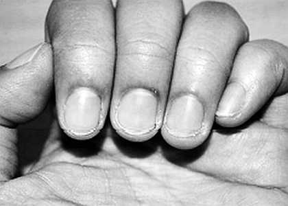 Иллюстрация к книге — Психология руки. Полный обзор теории и практики хиромантии [_16.jpg]