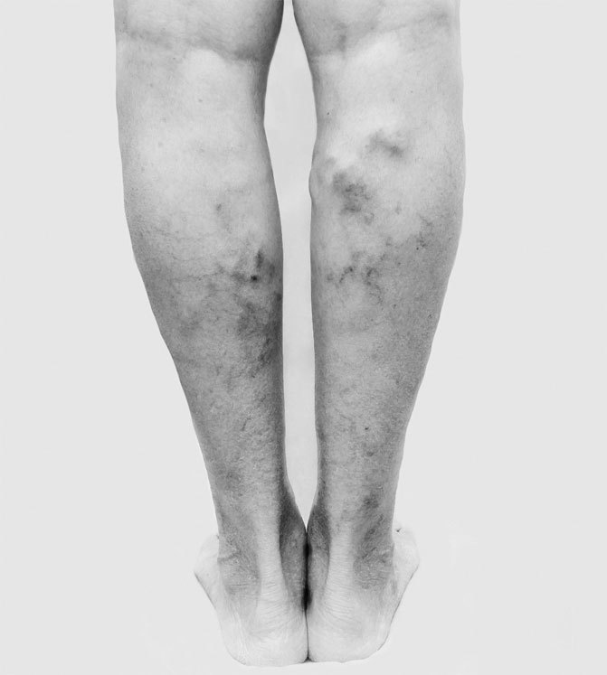 Иллюстрация к книге — Внутривенно. Что происходит с сосудами, по которым движется ваша кровь, как вылечить то, что уже болит, и не допустить проблем в будущем [i_004.jpg]