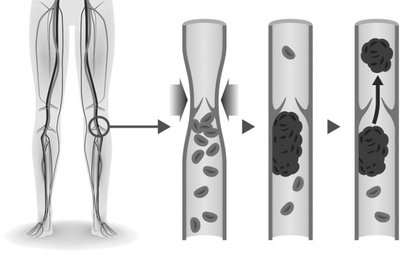 Иллюстрация к книге — Внутривенно. Что происходит с сосудами, по которым движется ваша кровь, как вылечить то, что уже болит, и не допустить проблем в будущем [i_012.jpg]