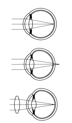 Иллюстрация к книге — Сохраните зрение! Лечебная гимнастика по Фохтину против близорукости, дальнозоркости, глаукомы, катаракты [i_015.jpg]