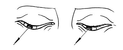 Иллюстрация к книге — Сохраните зрение! Лечебная гимнастика по Фохтину против близорукости, дальнозоркости, глаукомы, катаракты [i_019.jpg]