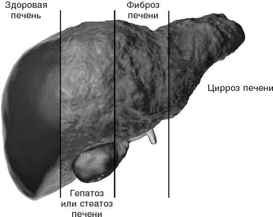 Иллюстрация к книге — О чем молчит печень. Как уловить сигналы самого крупного внутреннего органа, который предпочитает оставаться в тени [i_013.jpg]