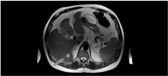 Иллюстрация к книге — О чем молчит печень. Как уловить сигналы самого крупного внутреннего органа, который предпочитает оставаться в тени [i_067.jpg]