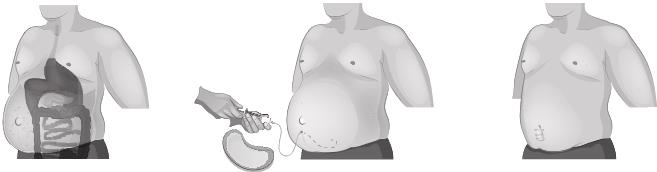 Иллюстрация к книге — О чем молчит печень. Как уловить сигналы самого крупного внутреннего органа, который предпочитает оставаться в тени [i_085.jpg]