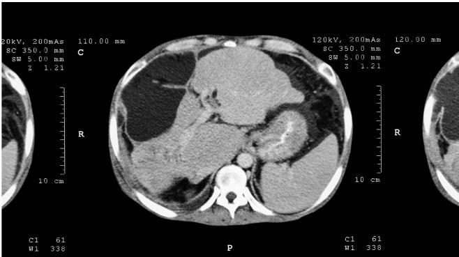 Иллюстрация к книге — О чем молчит печень. Как уловить сигналы самого крупного внутреннего органа, который предпочитает оставаться в тени [i_088.jpg]