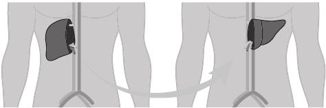 Иллюстрация к книге — О чем молчит печень. Как уловить сигналы самого крупного внутреннего органа, который предпочитает оставаться в тени [i_128.jpg]