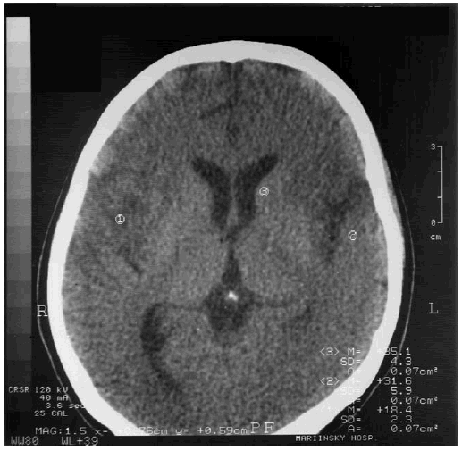 Иллюстрация к книге — Деменция. Диагностика и лечение [i_007.jpg]