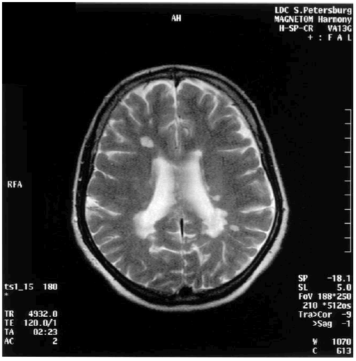 Иллюстрация к книге — Деменция. Диагностика и лечение [i_010.jpg]
