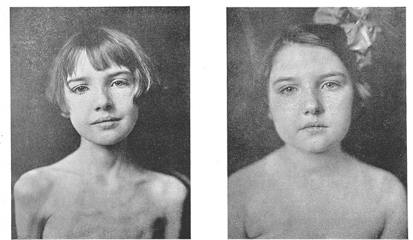 Иллюстрация к книге — Интервальное голодание. Как восстановить свой организм, похудеть и активизировать работу мозга [i_048.jpg]