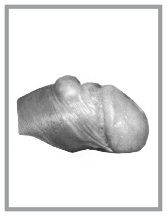 Иллюстрация к книге — «Главный» мужской орган. Медицинские исследования, исторические факты и забавные культурные феномены [i_033.jpg]