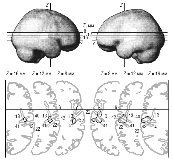 Иллюстрация к книге — Чеширская улыбка кота Шрёдингера: мозг, язык и сознание [i_048.jpg]