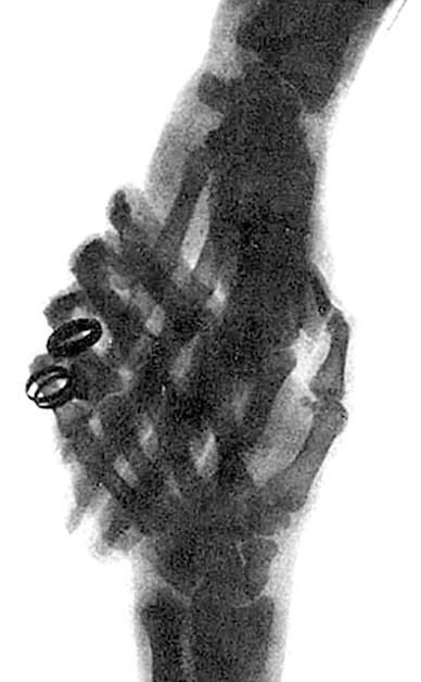 Иллюстрация к книге — Солнечное вещество и другие повести, а также Жизнь и судьба Матвея Бронштейна и Лидии Чуковской (сборник) [i_036.jpg]