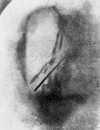 Иллюстрация к книге — Солнечное вещество и другие повести, а также Жизнь и судьба Матвея Бронштейна и Лидии Чуковской (сборник) [i_047.jpg]