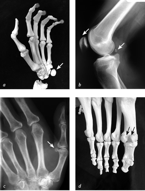 Иллюстрация к книге — Кости: внутри и снаружи [i_007.jpg]
