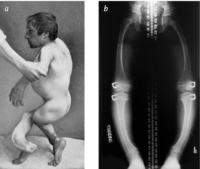 Иллюстрация к книге — Кости: внутри и снаружи [i_015.jpg]