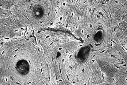 Иллюстрация к книге — Кости: внутри и снаружи [i_016.jpg]