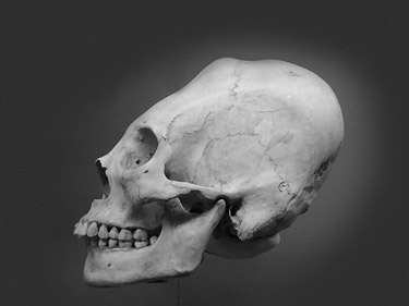 Иллюстрация к книге — Кости: внутри и снаружи [i_017.jpg]