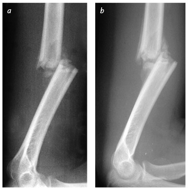 Иллюстрация к книге — Кости: внутри и снаружи [i_019.jpg]