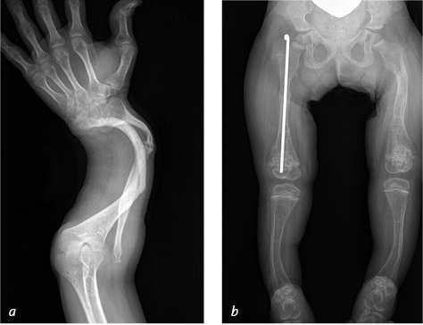 Иллюстрация к книге — Кости: внутри и снаружи [i_022.jpg]