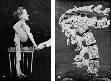 Иллюстрация к книге — Кости: внутри и снаружи [i_023.jpg]