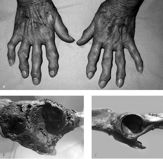 Иллюстрация к книге — Кости: внутри и снаружи [i_024.jpg]