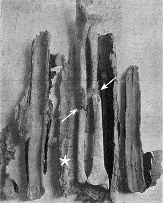 Иллюстрация к книге — Кости: внутри и снаружи [i_026.jpg]