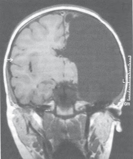 Иллюстрация к книге — Сознание за пределами жизни. Наука о жизни после смерти [i_022.jpg]