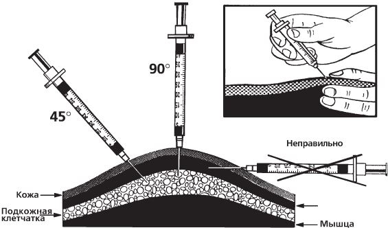 Иллюстрация к книге — Настольная книга диабетика. Как наладить жизнь с непростым диагнозом [i_016.jpg]
