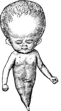 Иллюстрация к книге — По голове себе постучи. Вся правда о мигрени и другой головной боли [i_024.jpg]