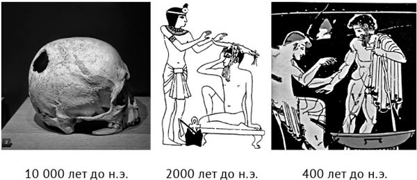 Иллюстрация к книге — По голове себе постучи. Вся правда о мигрени и другой головной боли [i_029.jpg]