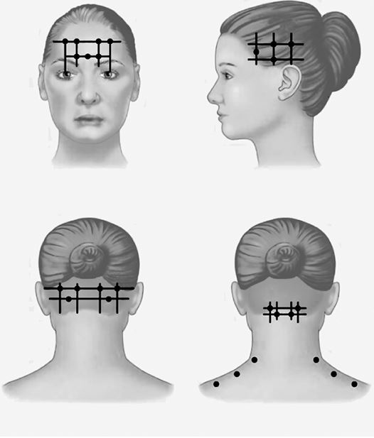 Иллюстрация к книге — По голове себе постучи. Вся правда о мигрени и другой головной боли [i_057.jpg]