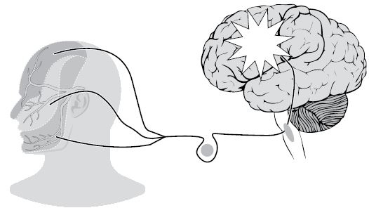 Иллюстрация к книге — По голове себе постучи. Вся правда о мигрени и другой головной боли [i_076.jpg]