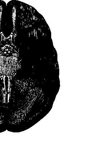 Иллюстрация к книге — По голове себе постучи. Вся правда о мигрени и другой головной боли [i_081.jpg]