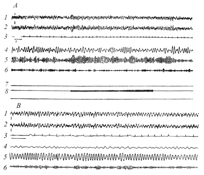 Иллюстрация к книге — Эмоциональный мозг [i_014.jpg]