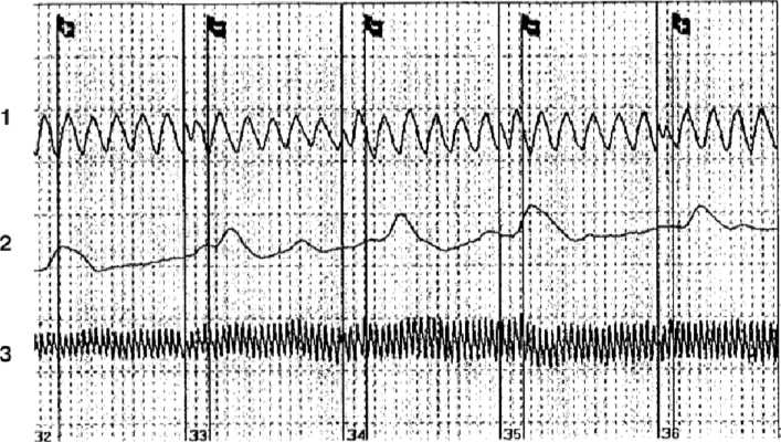 Иллюстрация к книге — Детектор лжи [i_012.jpg]