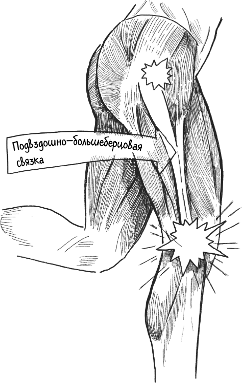 Иллюстрация к книге — Колени. Как у вас дела? Как ухаживать за одним из самых уязвимых суставов и не пропустить проблемы [i_008.jpg]