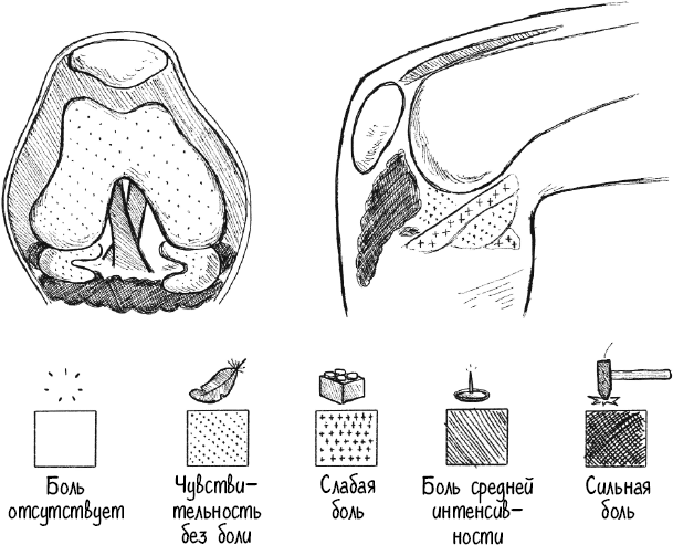 Иллюстрация к книге — Колени. Как у вас дела? Как ухаживать за одним из самых уязвимых суставов и не пропустить проблемы [i_013.jpg]