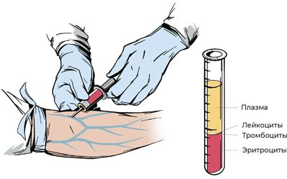 Иллюстрация к книге — Пять литров красного. Что необходимо знать о крови, ее болезнях и лечении [i_047.jpg]