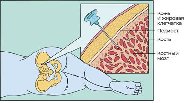 Иллюстрация к книге — Пять литров красного. Что необходимо знать о крови, ее болезнях и лечении [i_053.jpg]