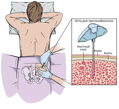 Иллюстрация к книге — Пять литров красного. Что необходимо знать о крови, ее болезнях и лечении [i_056.jpg]